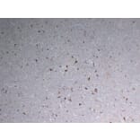 Immunohistochemistry - Anti-CD68 Antibody (V0035) - Antibodies.com