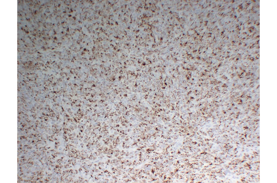 Immunohistochemistry - Anti-CD68 Antibody (V0035) - Antibodies.com