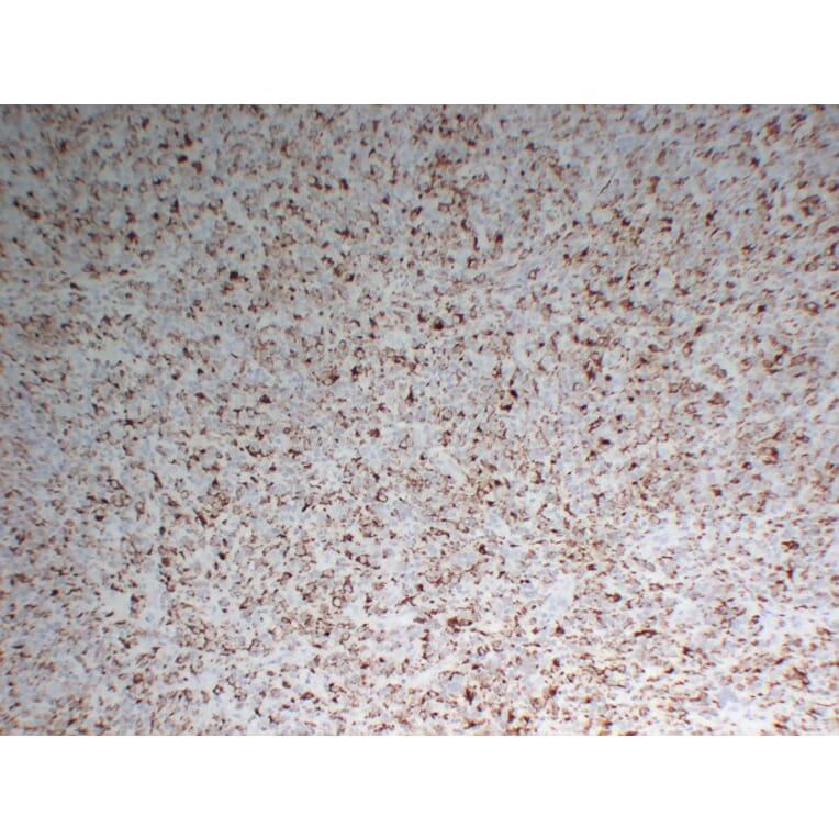 Immunohistochemistry - Anti-CD68 Antibody (V0035) - Antibodies.com