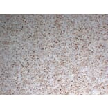 Immunohistochemistry - Anti-CD68 Antibody (V0035) - Antibodies.com