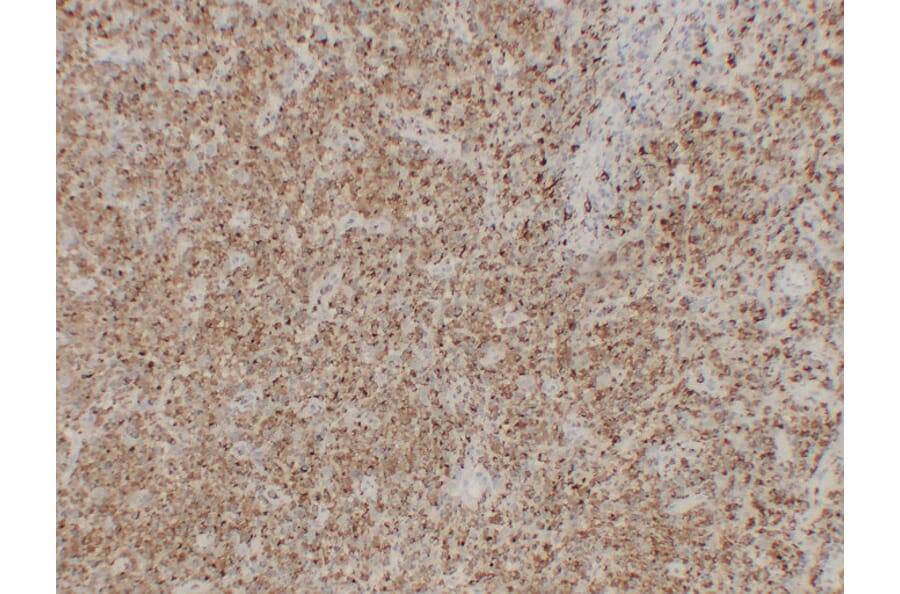 Immunohistochemistry - Anti-CD68 Antibody (V0035) - Antibodies.com