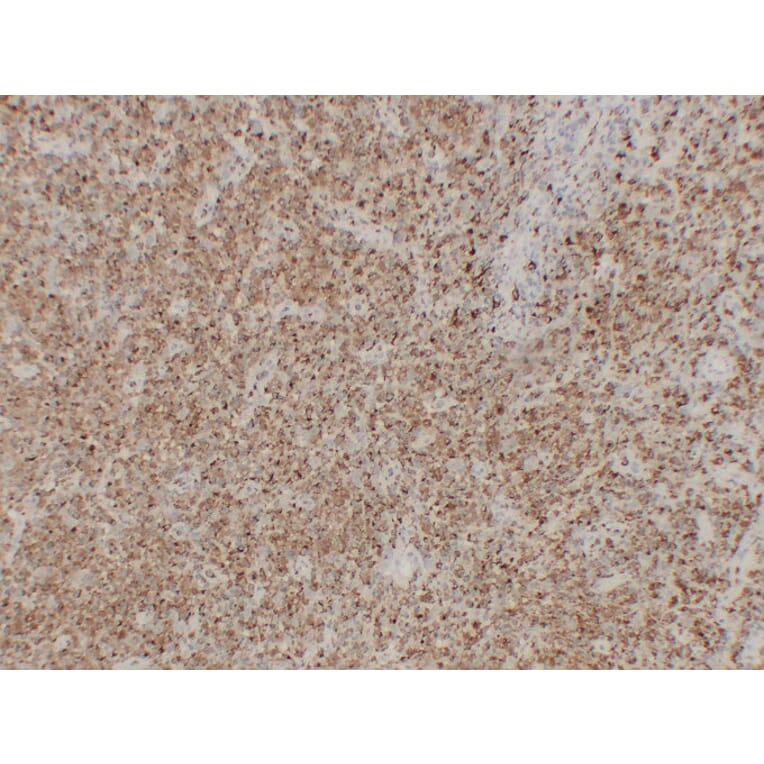 Immunohistochemistry - Anti-CD68 Antibody (V0035) - Antibodies.com