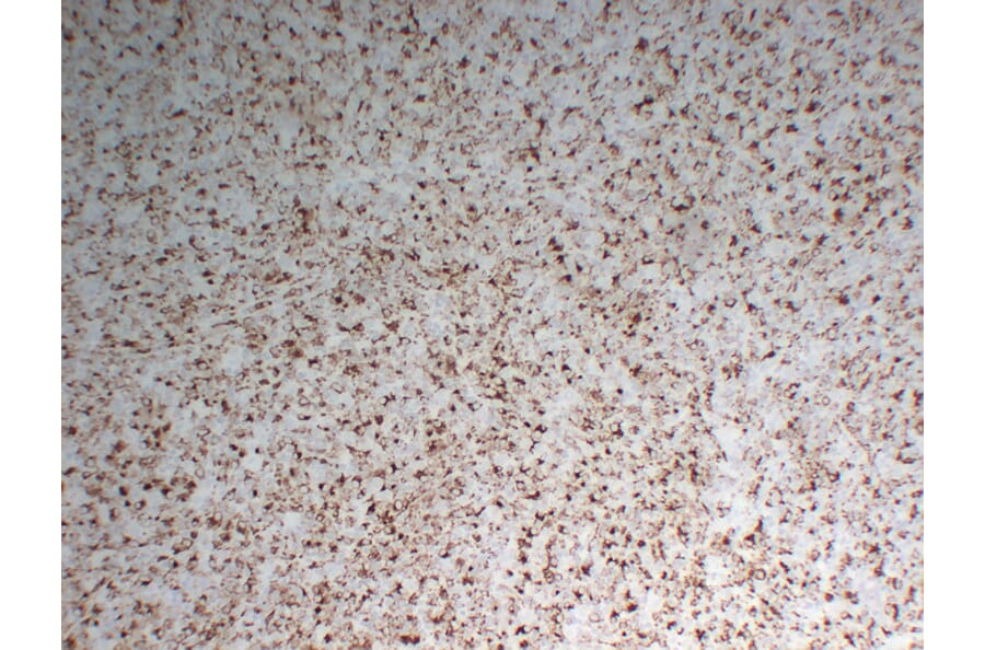 Immunohistochemistry - Anti-CD68 Antibody (V0035) - Antibodies.com