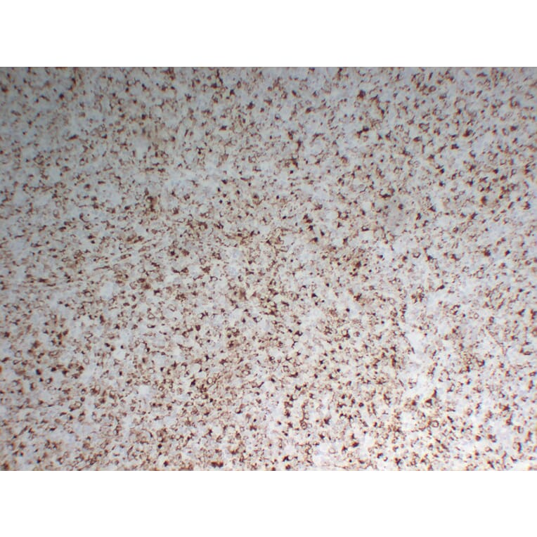 Immunohistochemistry - Anti-CD68 Antibody (V0035) - Antibodies.com