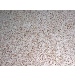 Immunohistochemistry - Anti-CD68 Antibody (V0035) - Antibodies.com