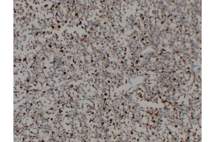 Immunohistochemistry - Anti-CD68 Antibody (V0035) - Antibodies.com
