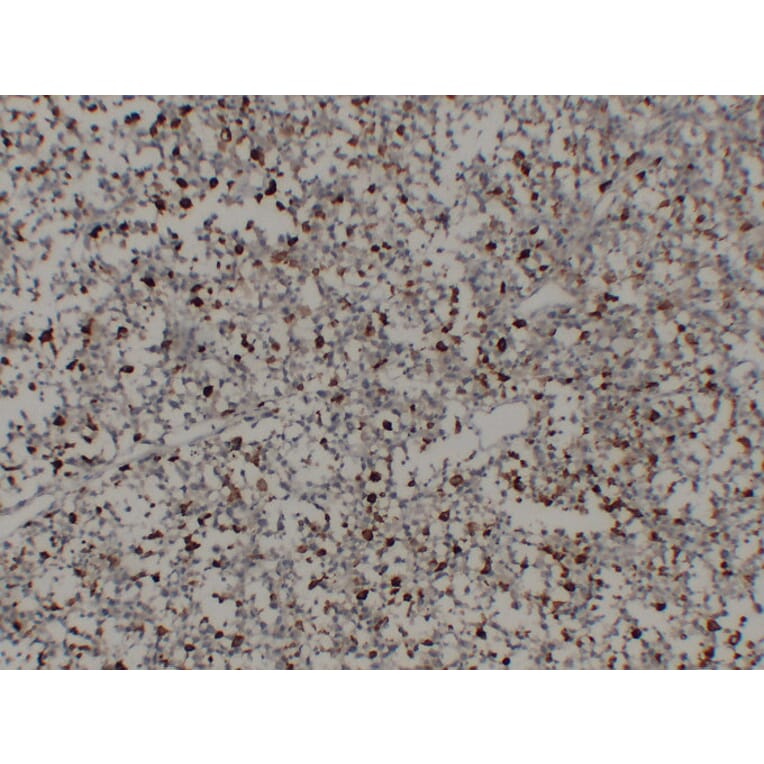 Immunohistochemistry - Anti-CD68 Antibody (V0035) - Antibodies.com