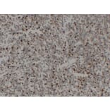 Immunohistochemistry - Anti-CD68 Antibody (V0035) - Antibodies.com