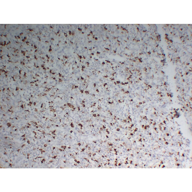 Immunohistochemistry - Anti-CD68 Antibody (V0035) - Antibodies.com