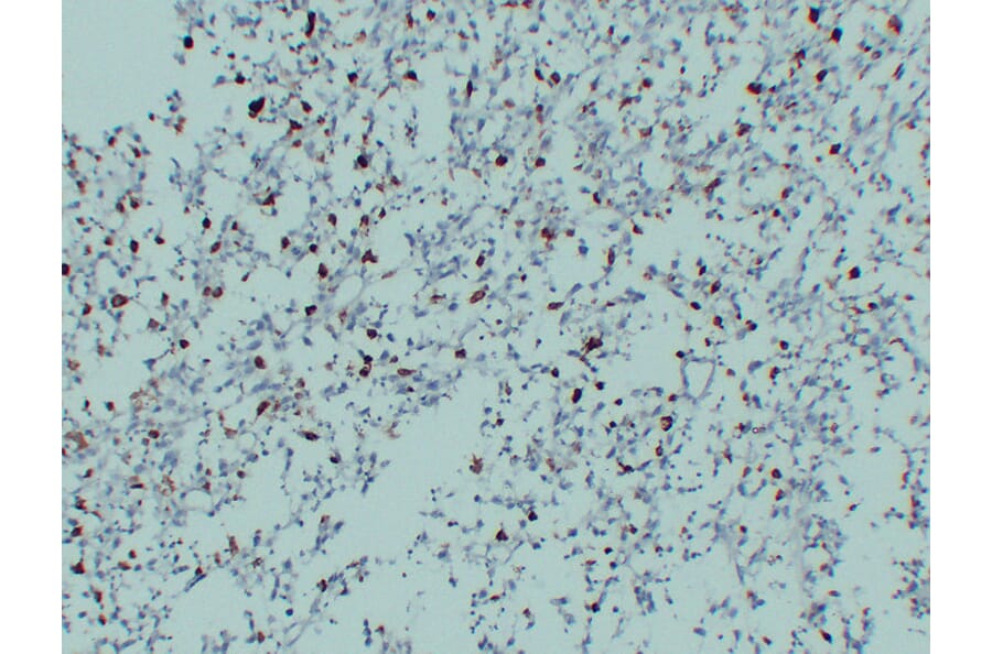 Immunohistochemistry - Anti-CD68 Antibody (V0035) - Antibodies.com