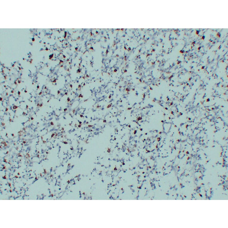 Immunohistochemistry - Anti-CD68 Antibody (V0035) - Antibodies.com
