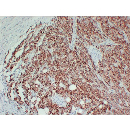 Immunohistochemistry - Anti-CD63 Antibody (V0034) - Antibodies.com