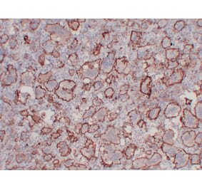 Immunohistochemistry - Anti-CD61 Antibody (V0033) - Antibodies.com