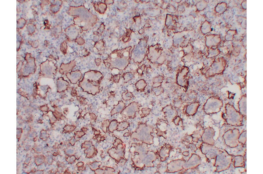 Immunohistochemistry - Anti-CD61 Antibody (V0033) - Antibodies.com