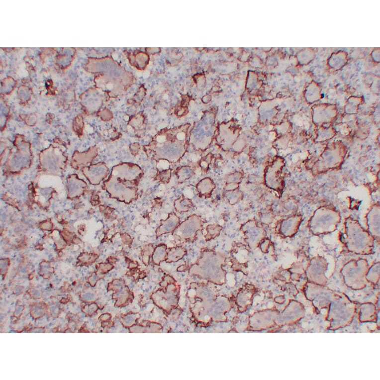 Immunohistochemistry - Anti-CD61 Antibody (V0033) - Antibodies.com