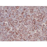 Immunohistochemistry - Anti-CD61 Antibody (V0033) - Antibodies.com