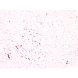 Immunohistochemistry - Anti-CD61 Antibody (V0033) - Antibodies.com