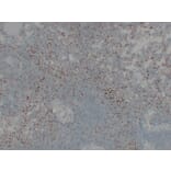 Immunohistochemistry - Anti-CD61 Antibody (V0033) - Antibodies.com