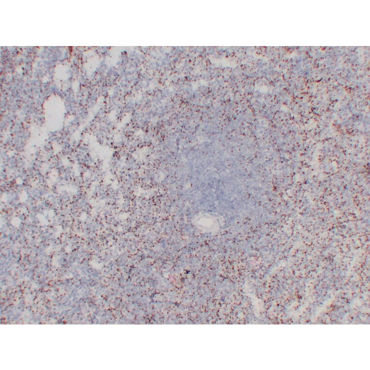 Immunohistochemistry - Anti-CD61 Antibody (V0033) - Antibodies.com