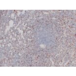 Immunohistochemistry - Anti-CD61 Antibody (V0033) - Antibodies.com