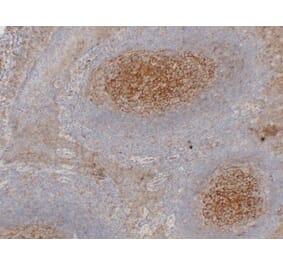 Immunohistochemistry - Anti-CD54 Antibody (V0031) - Antibodies.com