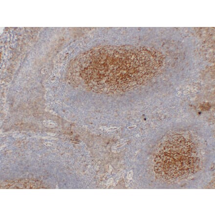 Immunohistochemistry - Anti-CD54 Antibody (V0031) - Antibodies.com