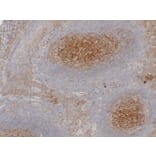 Immunohistochemistry - Anti-CD54 Antibody (V0031) - Antibodies.com