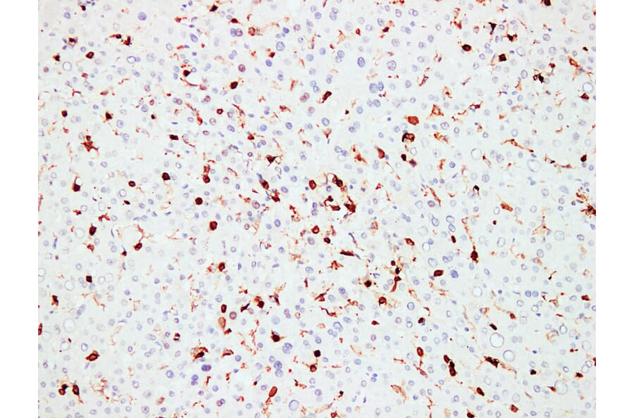 Immunohistochemistry - Anti-CD45 Antibody (V0029) - Antibodies.com