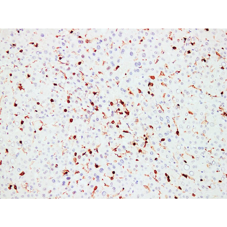 Immunohistochemistry - Anti-CD45 Antibody (V0029) - Antibodies.com