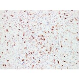 Immunohistochemistry - Anti-CD45 Antibody (V0029) - Antibodies.com