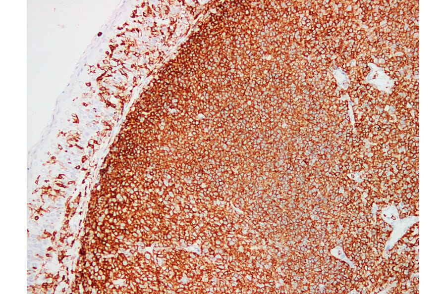 Immunohistochemistry - Anti-CD45 Antibody (V0029) - Antibodies.com