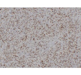 Immunohistochemistry - Anti-CD43 Antibody (V0027) - Antibodies.com