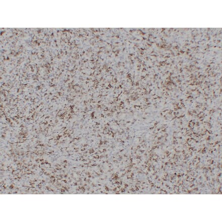 Immunohistochemistry - Anti-CD43 Antibody (V0027) - Antibodies.com
