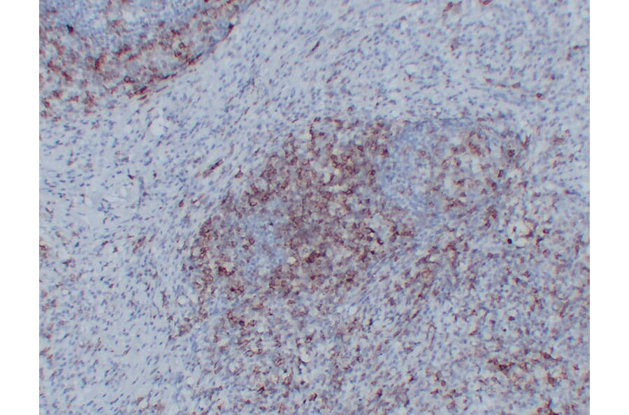 Immunohistochemistry - Anti-CD43 Antibody (V0027) - Antibodies.com