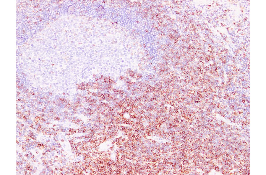 Immunohistochemistry - Anti-CD43 Antibody (V0027) - Antibodies.com