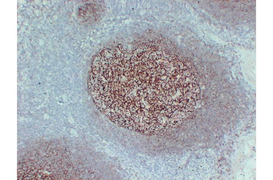 Immunohistochemistry - Anti-CD35 Antibody (V0024) - Antibodies.com