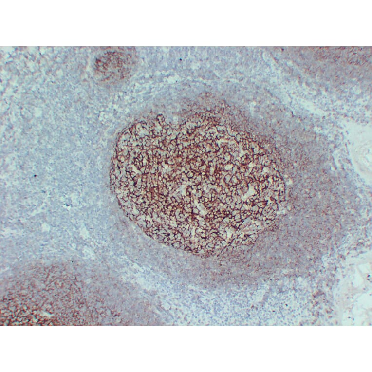 Immunohistochemistry - Anti-CD35 Antibody (V0024) - Antibodies.com