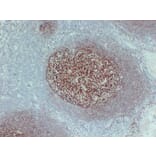 Immunohistochemistry - Anti-CD35 Antibody (V0024) - Antibodies.com