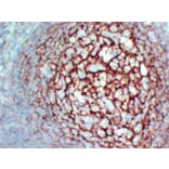 Immunohistochemistry - Anti-CD35 Antibody (V0024) - Antibodies.com
