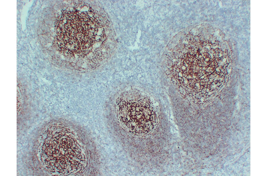 Immunohistochemistry - Anti-CD35 Antibody (V0024) - Antibodies.com