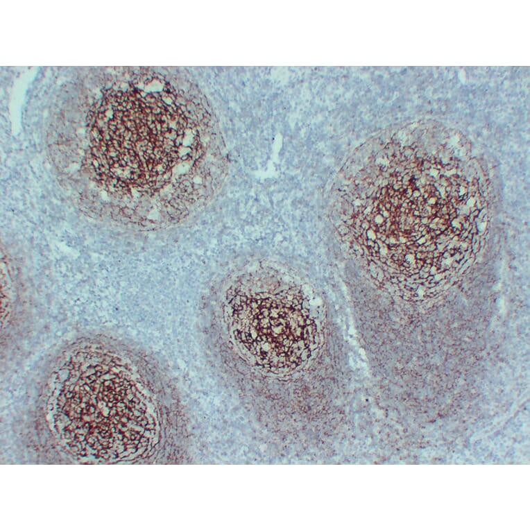 Immunohistochemistry - Anti-CD35 Antibody (V0024) - Antibodies.com