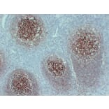 Immunohistochemistry - Anti-CD35 Antibody (V0024) - Antibodies.com