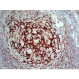 Immunohistochemistry - Anti-CD35 Antibody (V0024) - Antibodies.com