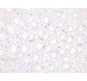 Immunohistochemistry - Anti-CD34 Antibody (V0023) - Antibodies.com