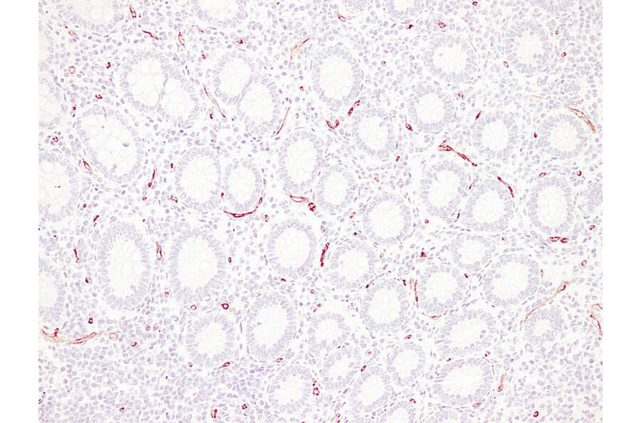 Immunohistochemistry - Anti-CD34 Antibody (V0023) - Antibodies.com
