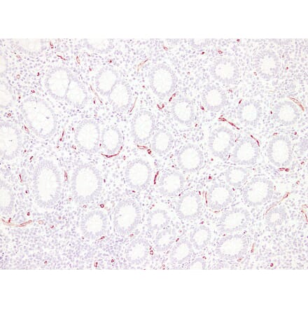 Immunohistochemistry - Anti-CD34 Antibody (V0023) - Antibodies.com