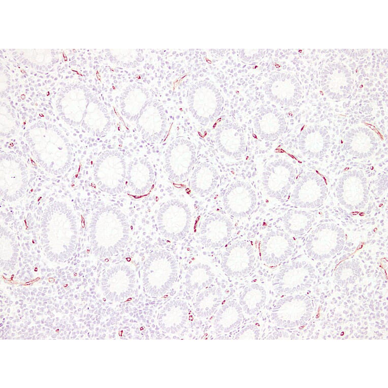 Immunohistochemistry - Anti-CD34 Antibody (V0023) - Antibodies.com