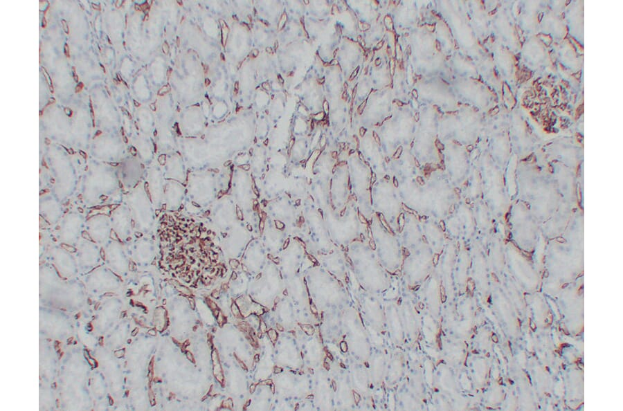 Immunohistochemistry - Anti-CD34 Antibody (V0023) - Antibodies.com