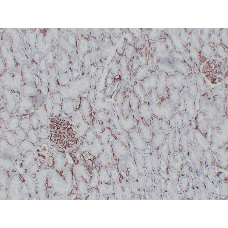 Immunohistochemistry - Anti-CD34 Antibody (V0023) - Antibodies.com