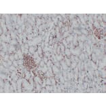 Immunohistochemistry - Anti-CD34 Antibody (V0023) - Antibodies.com